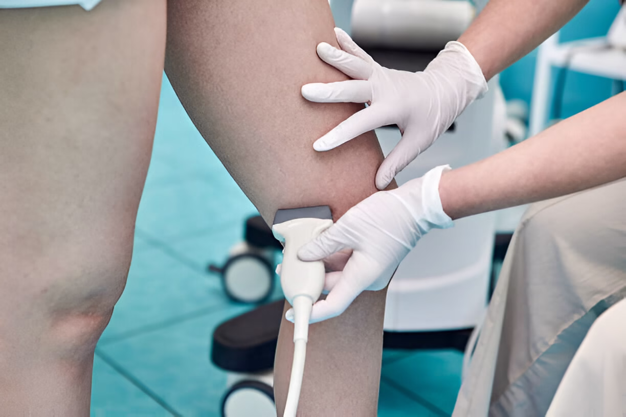 Vascular Ultrasound near me