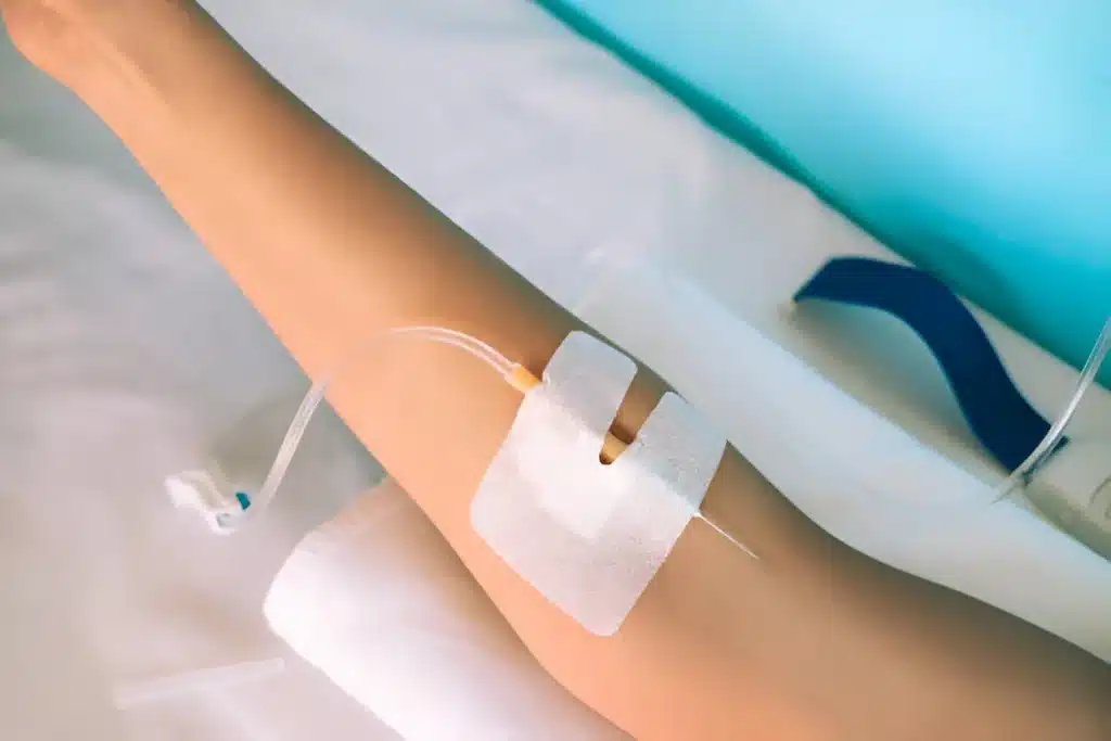 Texas immune system booster IV Therapy