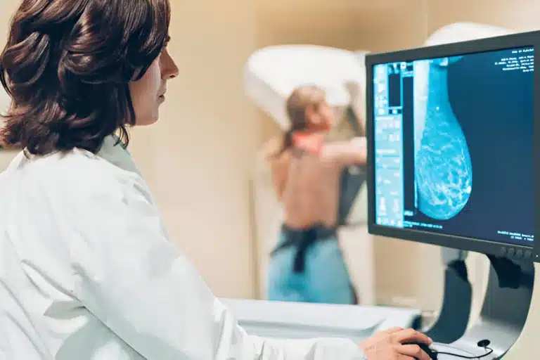 mammogram in burleson tx