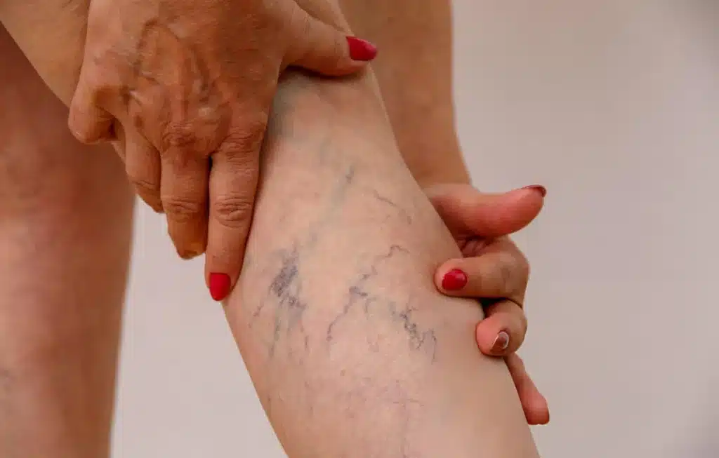 dl.beatsnoop.com final 6kfROIdUth